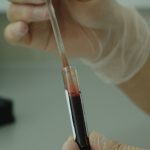 sangre prueba quimico lab