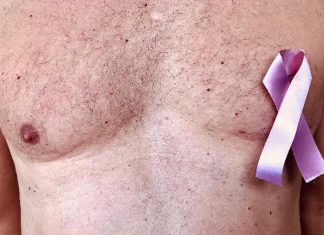El miedo es la primera barrera en la lucha contra el cáncer de mama: experta