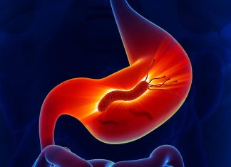 Bacteria Helicobacter pylori: un asalto silencioso al estómago