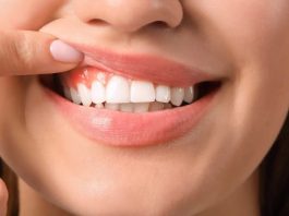 Cuidado con las bebidas ‘detox’, pueden dañar el esmalte dental