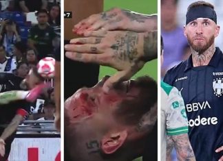 Sergio Ramos, capitán de Rayados, recibe terrible patada en la cara