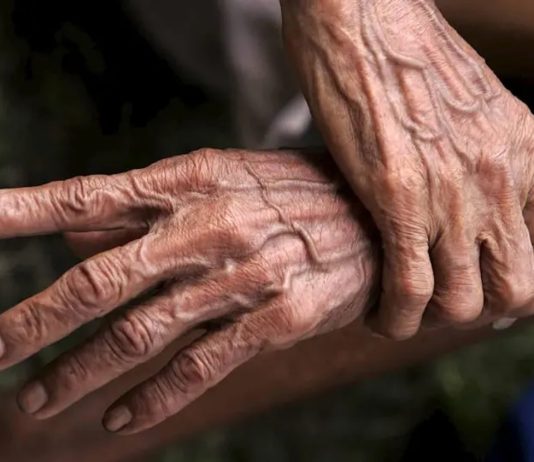 ¿Tiene fecha de caducidad nuestro cuerpo?